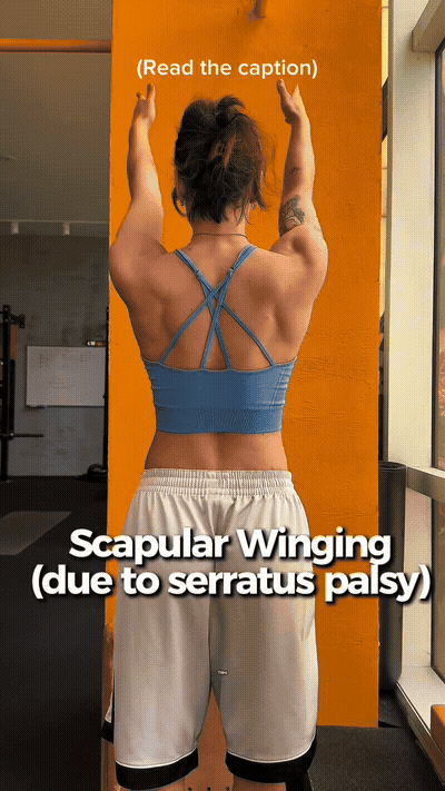 I'm going to show you how I fix my shoulders from this to this. First 